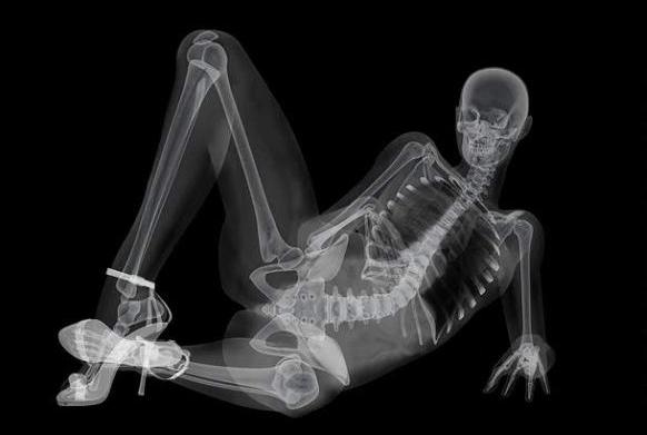 xray-naked-woman